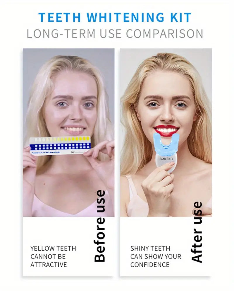 Bright Smile LED Whitening Kit