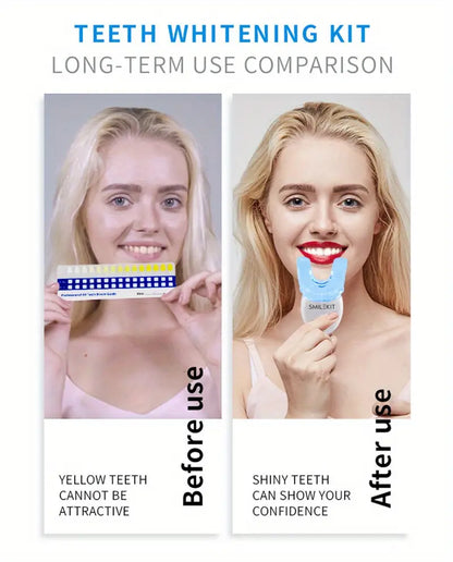 Bright Smile LED Whitening Kit